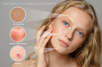 Skin Barrier and Causes of A Damaged Skin Barrier Skin Barrier and Causes of A Damaged Skin Barrier