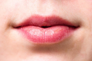 Dry Skin Around the Mouth: Causes, Prevention Tips, and Effective Treatments for Relief
