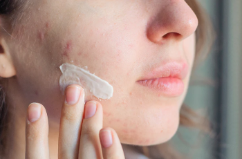 How Much Salicylic Acid Is Too Much for Skin? How Much Salicylic Acid Is Too Much for Skin?