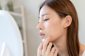 Say Goodbye to Breakouts: Non-Comedogenic Skincare That Works Say Goodbye to Breakouts: Non-Comedogenic Skincare That Works
