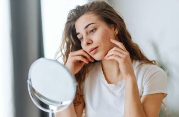 Comprehensive Guide to Understanding and Treating Cystic Acne