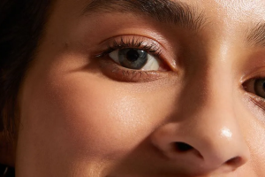 Effective Treatments for Dark Circles: Causes and Solutions Explained
