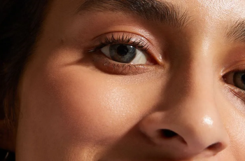 Effective Treatments for Dark Circles: Causes and Solutions Explained