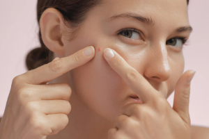Busting Acne Myths: What Really Works for Clear Skin