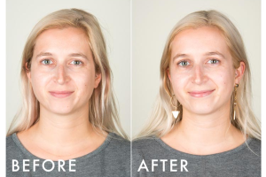 What Happens to Your Skin When You Quit Alcohol