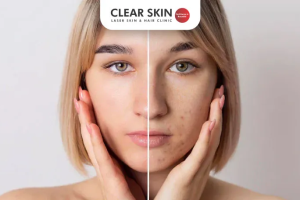 Even Out Your Skin Tone: Expert Tips for a Glowing, Balanced Complexion
