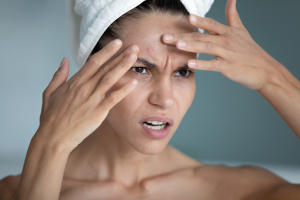 Beyond the Surface: When Skin Issues Trigger Emotional Pain