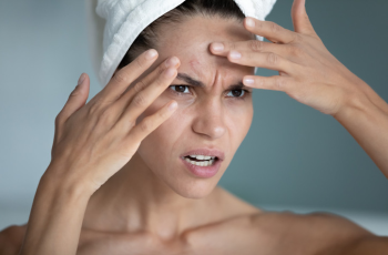 Beyond the Surface: When Skin Issues Trigger Emotional Pain