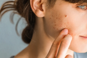 The Mood-Skin Connection: 5 Emotional Triggers That Affect Skin