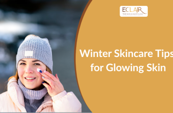 Winter Skincare Guide: Proven Tips to Lock In Moisture and Glow