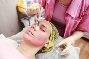 How Often Can You Use a Mandelic Acid Peel? A Complete Guide to Safe, Effective Exfoliation