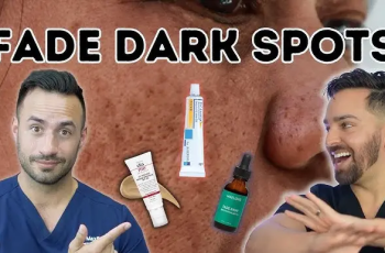 How to Get Rid of Melasma Naturally and Effectively: A Complete Guide to Fading Stubborn Dark Spots