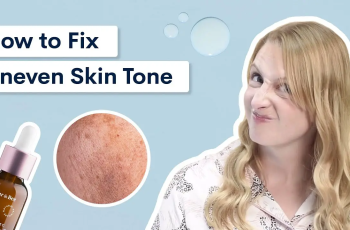 How to Improve Uneven Skin Tone Naturally and Effectively: A Complete Guide to Brighter, Balanced Skin