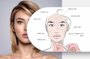 Treatment Approaches for Deep Wrinkles Around the Mouth Treatment Approaches for Deep Wrinkles Around the Mouth