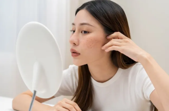 Skincare Science: Inflammation as a Root Cause of Dark Spots