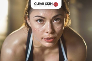 How to Protect Your Skin While Working Out