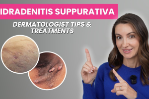 Dermatologist Skin-Care Tips for Hidradenitis Suppurativa: How to Prevent Flares